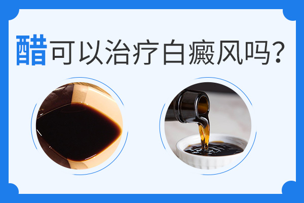 合肥白醋可(kě)以治療白癜風嗎(ma)？