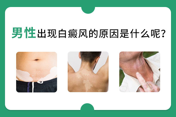 男性面部的白癜風是怎麽引發的?